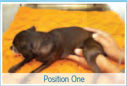 Cranial sacral therapy