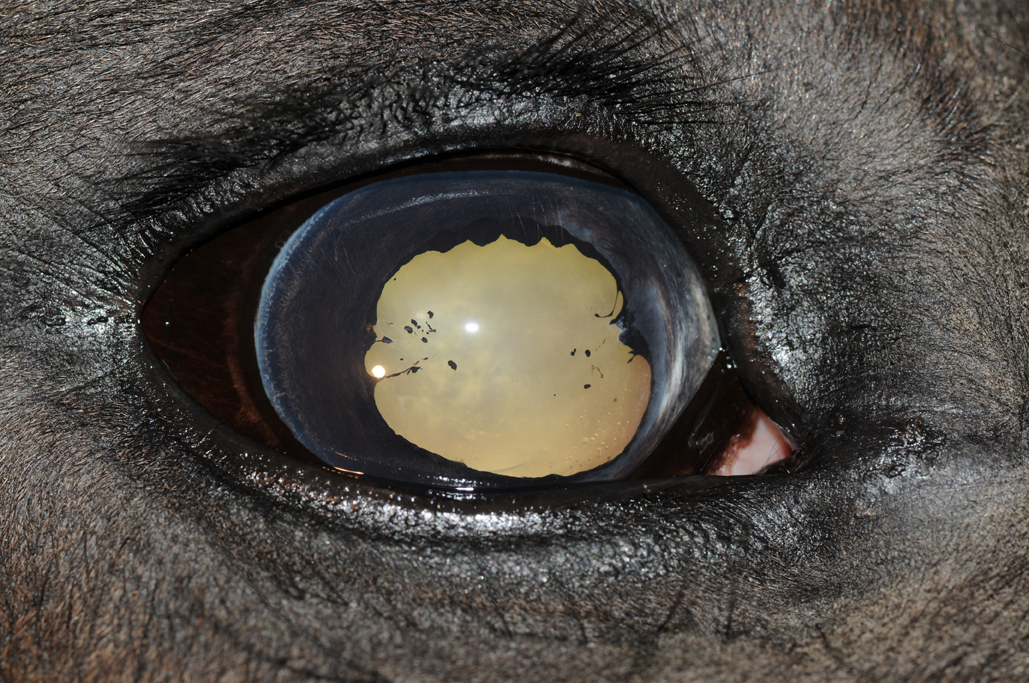 uveitis