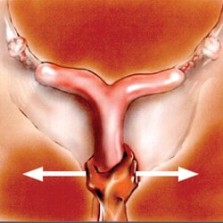 uterus1