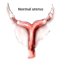 uterus2a