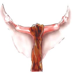 uterus3