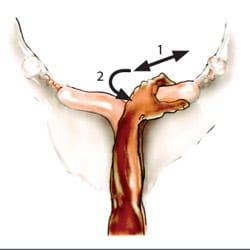 uterus4