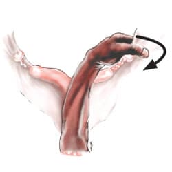 uterus6